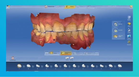 CEREC Design-Service