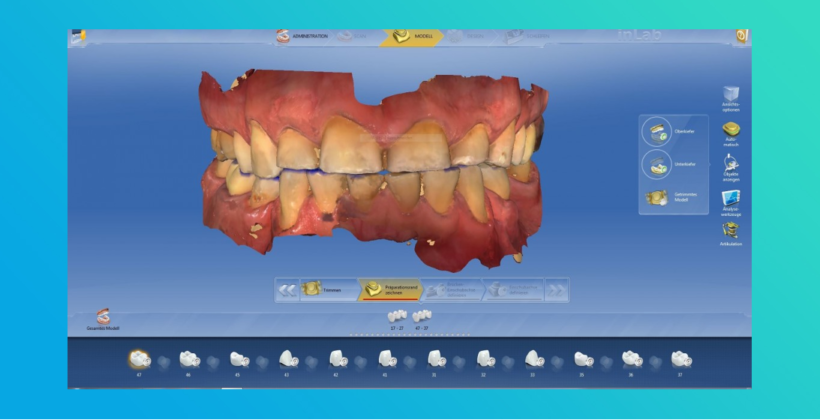 CEREC Design-Service